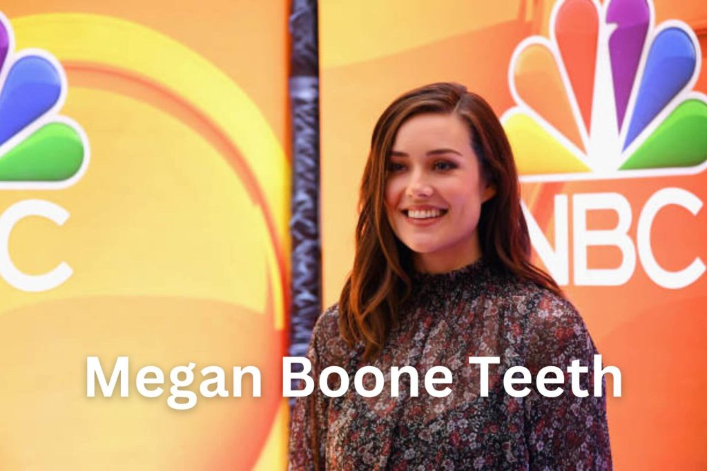 Megan Boone Teeth